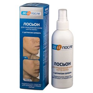 До и после Анти-акне Лосьон д/проблемной кожи 200мл